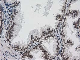 PRKCE / PKC-Epsilon Antibody (clone OTI1B4)