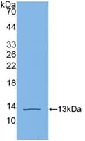 Complement C4b Antibody (aa680-756)