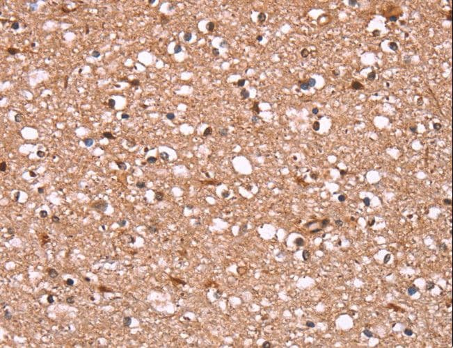 FBXO31 Antibody