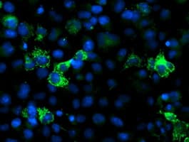NUDT9 Antibody (clone OTI7A12)