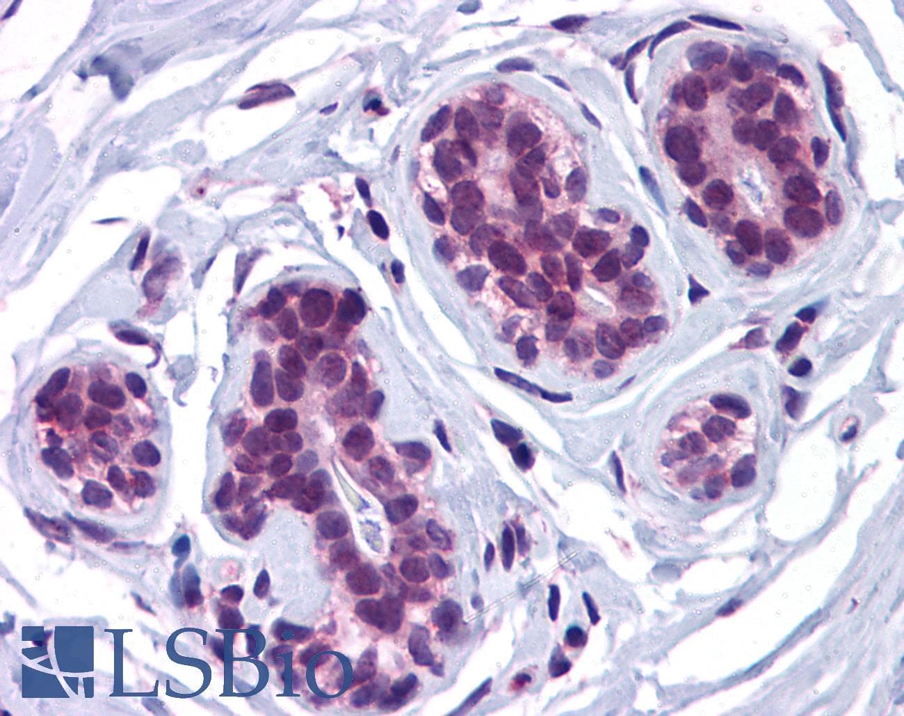IHC-plus™ KIAA0652 / ATG13 Antibody