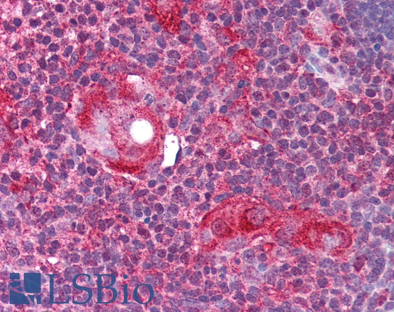 IHC-plus™ Polyclonal Rabbit anti-Human ATG9A Antibody (aa750-839, IHC, WB)