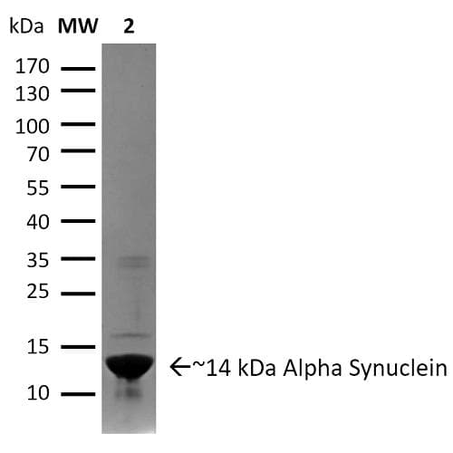 Human SNCA / Alpha-Synuclein Protein (Recombinant)