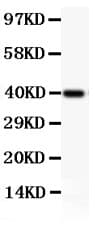 Polyclonal Rabbit anti-Human NFKB1 / NF-Kappa-B Antibody (aa1-360, IHC, WB)