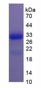 Human RNASE2 / EDN Protein (Recombinant His-SUMO, N-terminus)