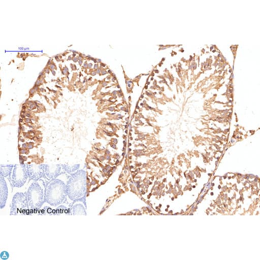 APG5 / ATG5 Antibody