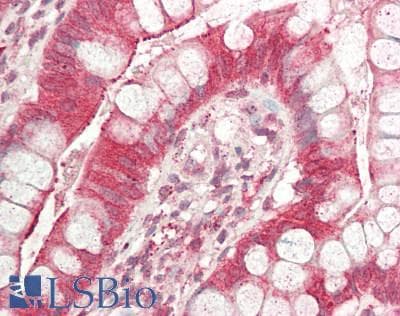 IHC-plus™ VIL1 / Villin Antibody