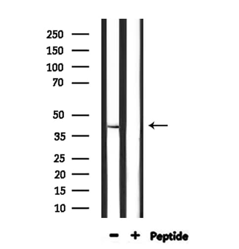 STAC3 Antibody
