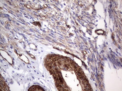 Monoclonal Mouse anti-Human MCAM / CD146 Antibody (clone UMAB155, Carrier-free, IHC, WB)