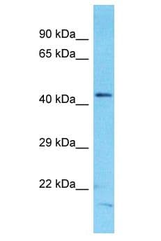 Polyclonal Rabbit anti-Human CDCA1 / NUF2 Antibody (aa13-62, WB)