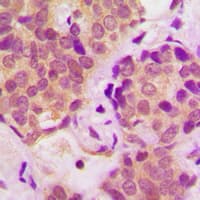 STAT6 Antibody (phospho-Tyr641)