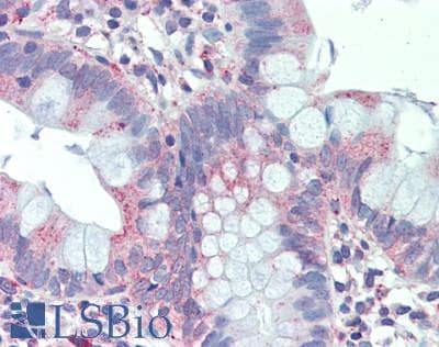 IHC-plus™ DSG2 / Desmoglein 2 Antibody (aa925-975)
