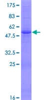 Human MECOM / EVI1 Protein (Recombinant GST)