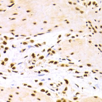 Polyclonal Rabbit anti-Human DDB1 Antibody (IHC, WB)