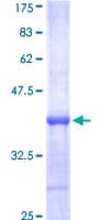 Human BTK Protein (Recombinant GST, N-terminus)