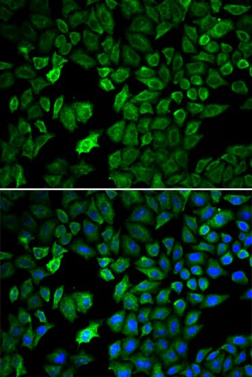 PRMT5 Antibody