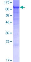 Human ACS5 / ACSL5 Protein (Recombinant GST)
