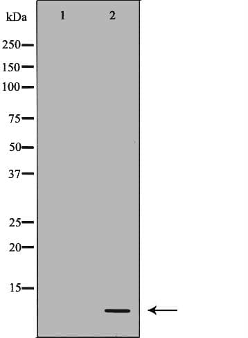 Polyclonal Rabbit anti-Human DEFB121 Antibody (IHC, IF, WB)