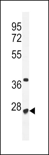 RRP36 Antibody (aa230-259)