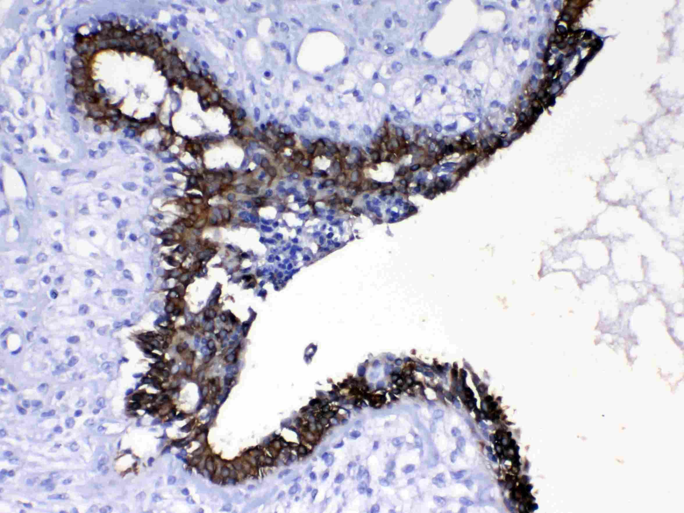 KRT8 / CK8 / Cytokeratin 8 Antibody