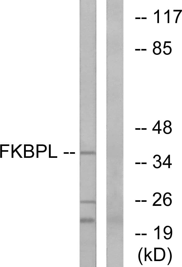 FKBPL Antibody (aa251-300)