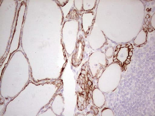 Monoclonal Mouse anti-Human ABCB1 / MDR1 / P Glycoprotein Antibody (clone OTI11D2, aa995-1280, IHC)