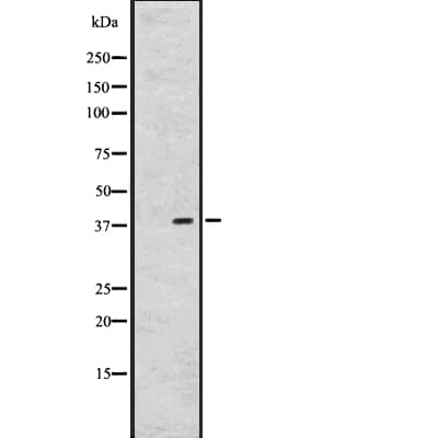 Polyclonal Rabbit anti-Human GPR26 Antibody (WB)