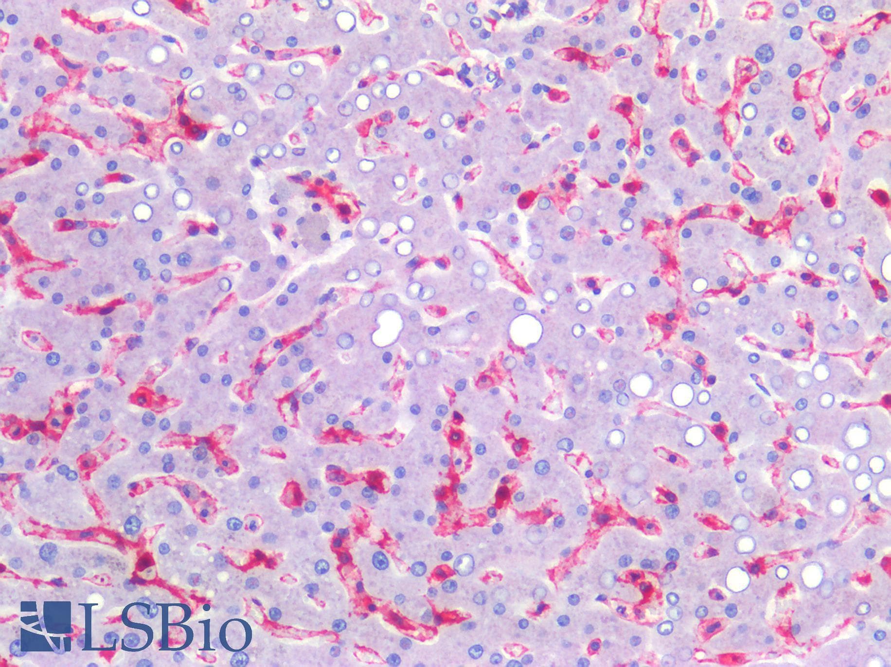 IHC-plus™ CAV1 / Caveolin 1 Antibody (C-Terminus)