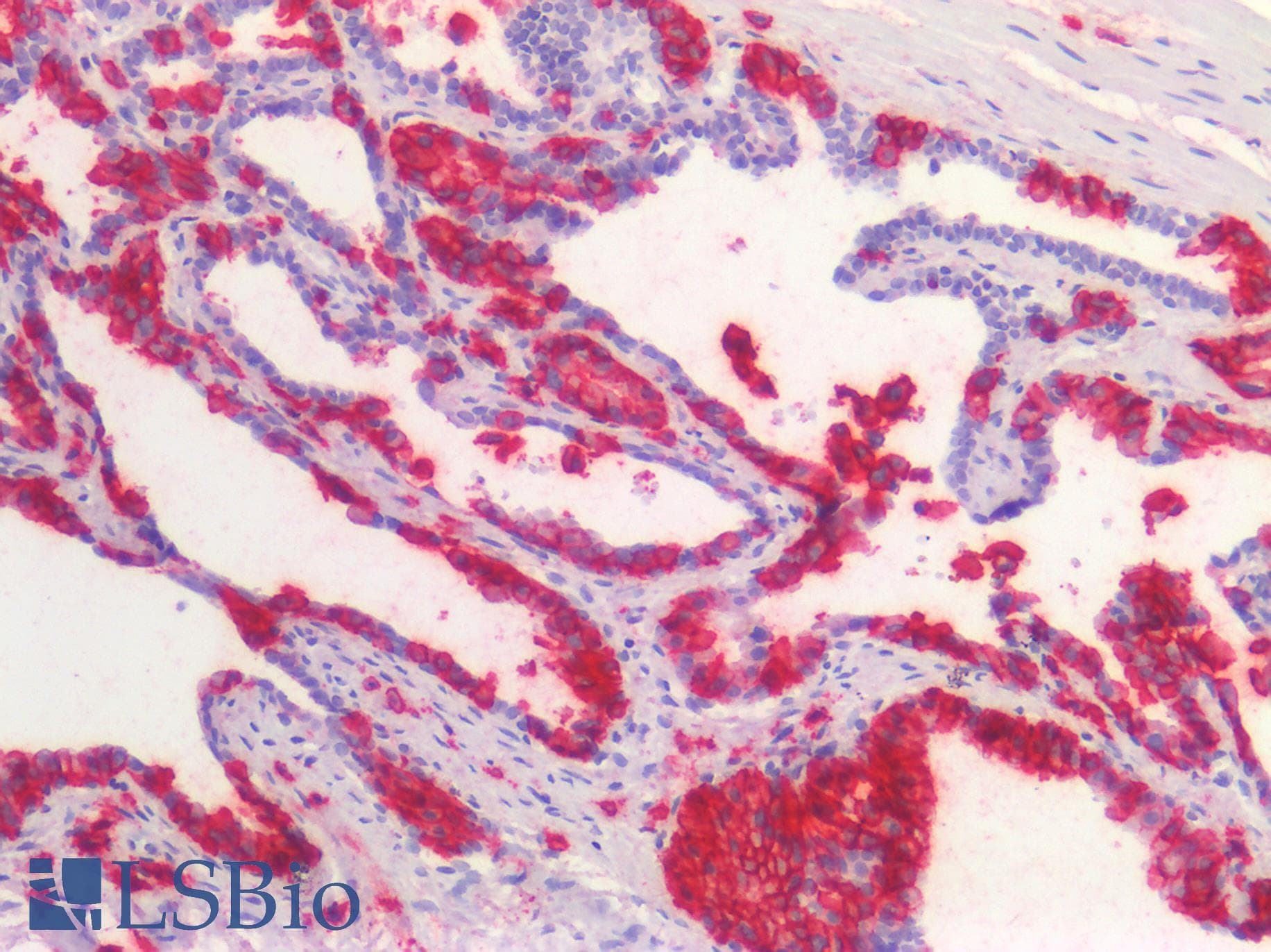 PathPlus™ CD38 Antibody (clone 6E12D4A12)
