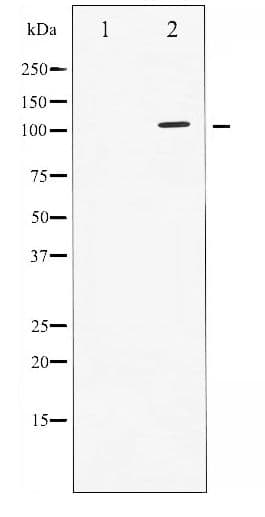 Polyclonal Rabbit anti-Human STAT2 Antibody (phospho-Tyr690, IHC, WB)