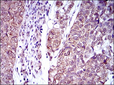 IL2RA / CD25 Antibody (aa34-139, clone 1B5D12)