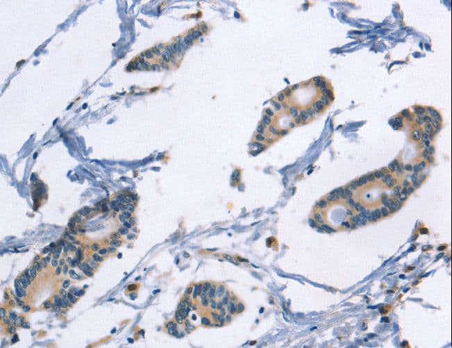 Polyclonal Rabbit anti-Human TLR8 Antibody (IHC)