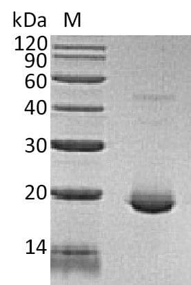 Human IL6 / Interleukin 6 Protein (Recombinant)