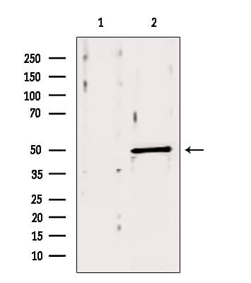 IHC-plus™ Polyclonal Rabbit anti-Human ACOX1 / ACOX Antibody (IHC, WB)