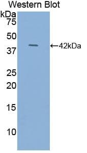 NT-proANP Antibody (aa25-123)