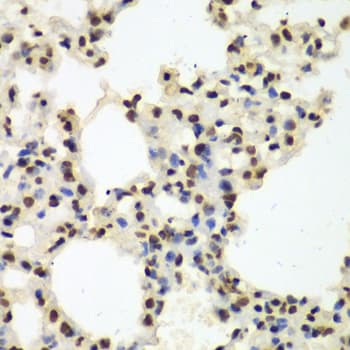Polyclonal Rabbit anti-Human NONO / P54NRB Antibody (IHC, IF, WB)