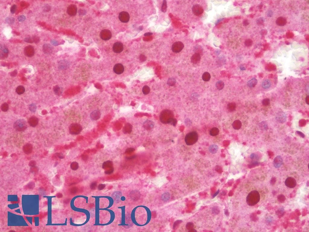 IHC-plus™ Polyclonal Rabbit anti-Human ULK3 Antibody (IHC, IF, WB)