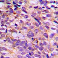 PRAGMIN / SGK223 Antibody (phospho-Tyr413)