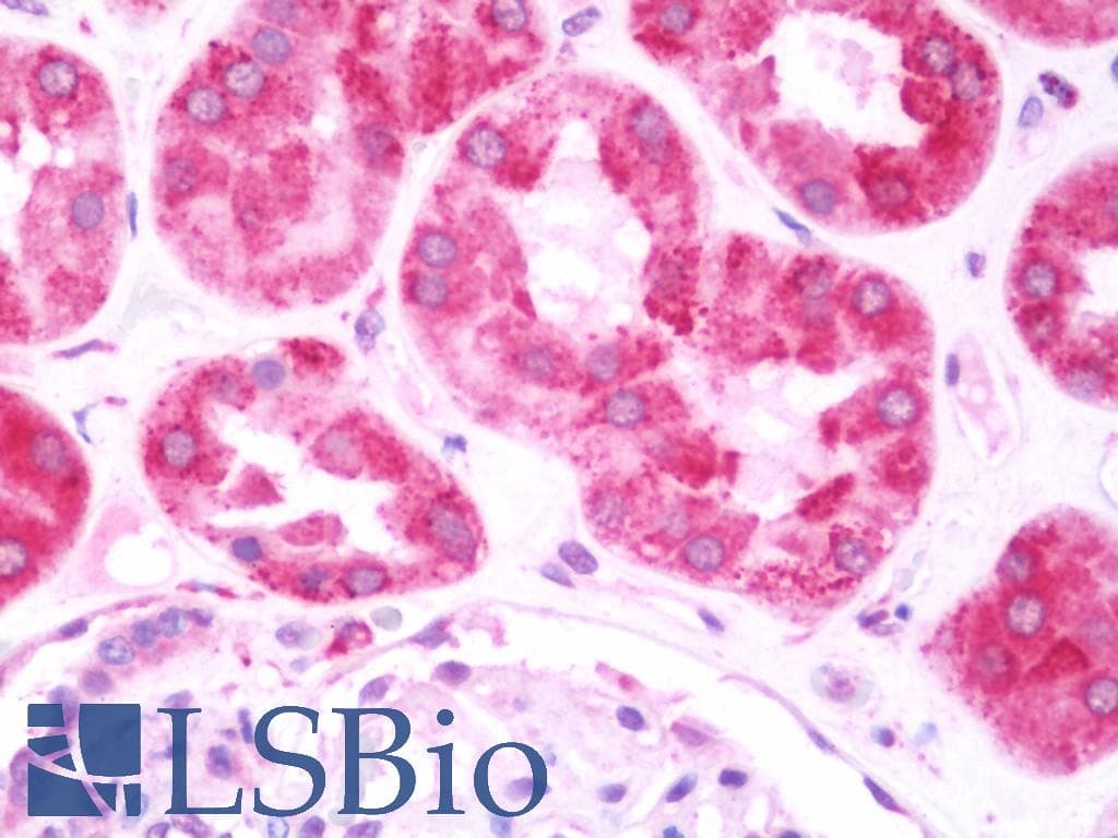 IHC-plus™ Polyclonal Rabbit anti-Human LRPAP1 Antibody (IHC, WB)