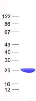 Human LYPLA1 Protein (Recombinant His, N-Terminal)
