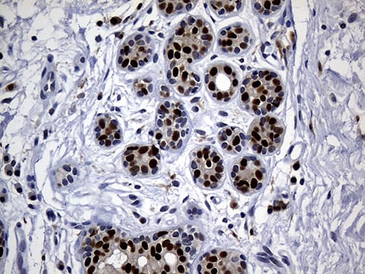 ALOX5 / 5-LOX Antibody (aa18-364, clone OTI1C1)
