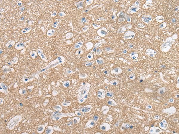 CADM2 Antibody
