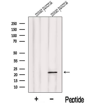 LOH12CR1 Antibody