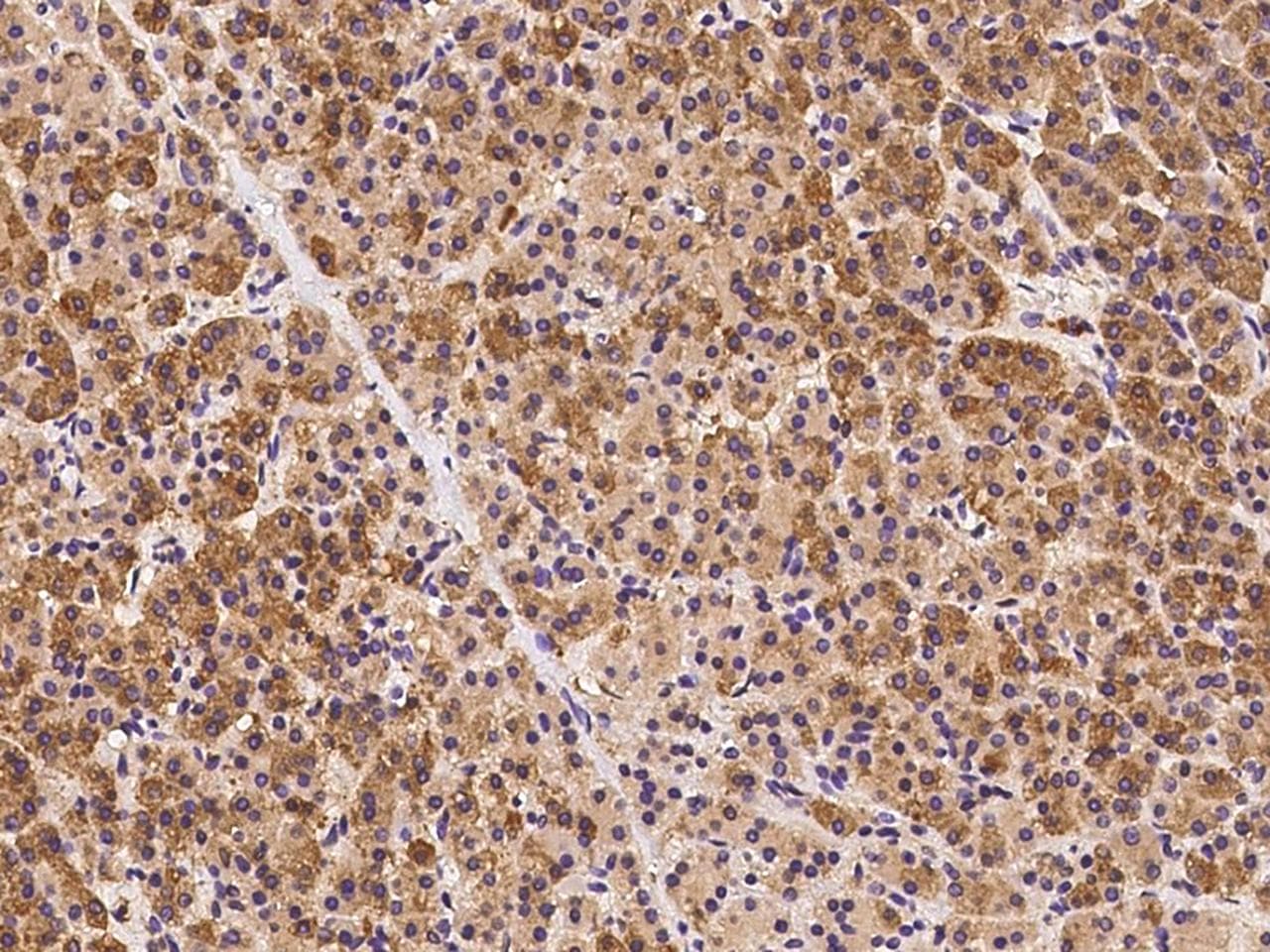 Dynactin 3 / DCTN3 Antibody