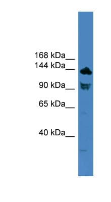 Polyclonal Rabbit anti-Human TLR8 Antibody (C-Terminus, WB)