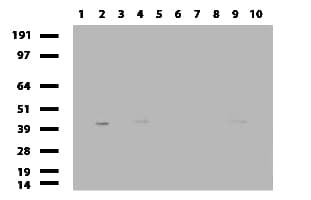 NKX3-1 Antibody (clone UMAB196)