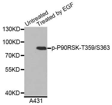 RPS6KA1 / RSK1 Antibody (phospho-Thr359/Ser363)
