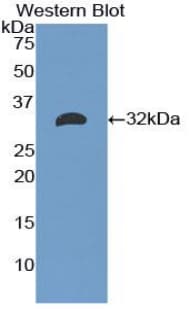 MBL2 / Mannose Binding Protein Antibody (aa19-244, Cy3)