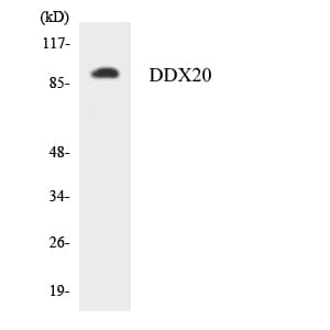 Polyclonal Rabbit anti-Human DDX20 / GEMIN3 Antibody (aa254-303, WB)
