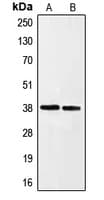 Polyclonal Rabbit anti-Human EFNA3 / Ephrin A3 Antibody (C-Terminus, IF, WB)